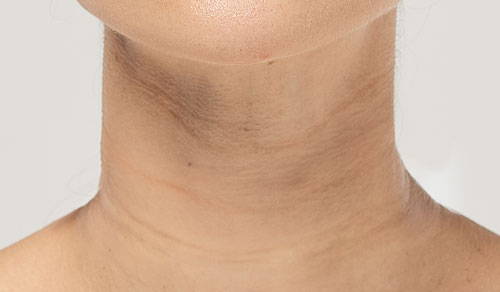 Un coup parfait après utilisation des patchs anti-rides