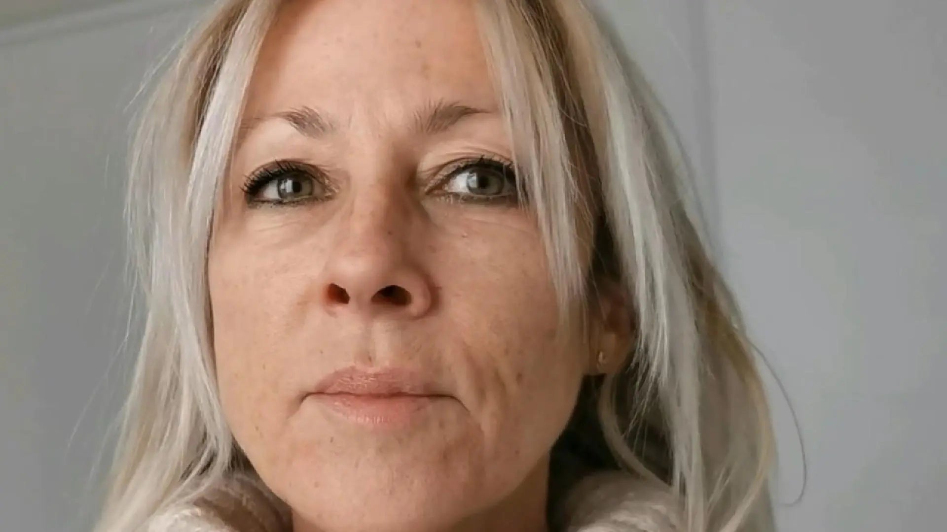 Avant utilisation des patchs anti-rides