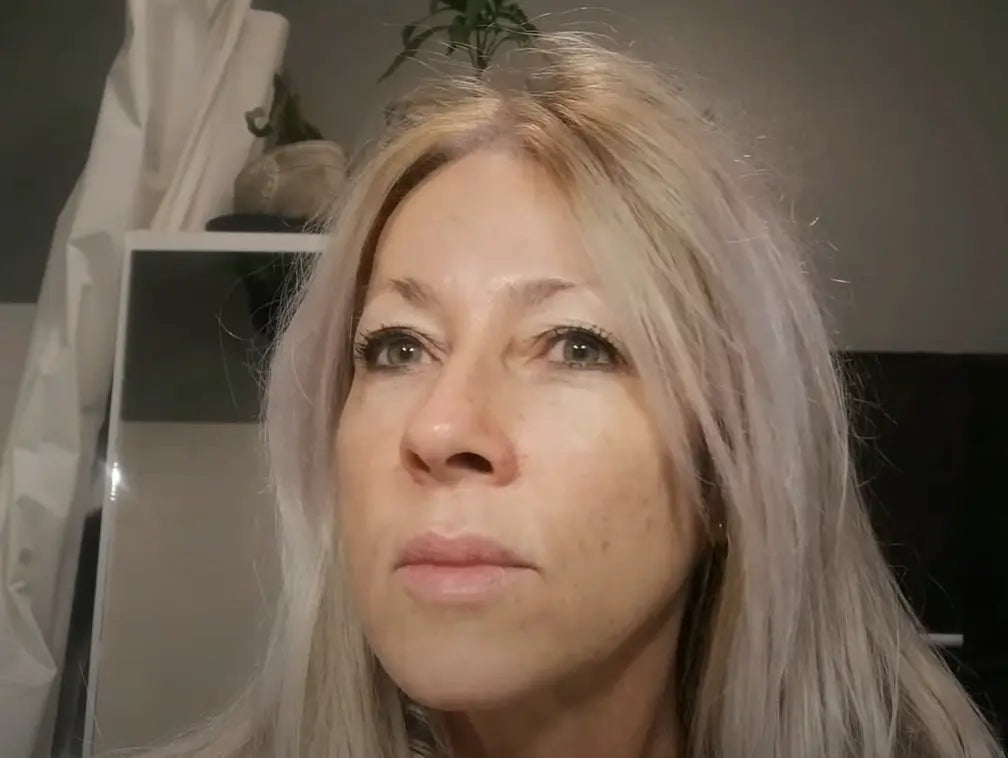 Après utilisation des patchs anti-rides